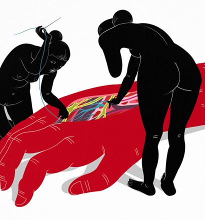 Bryce Wymer - Casorati's Surgeons